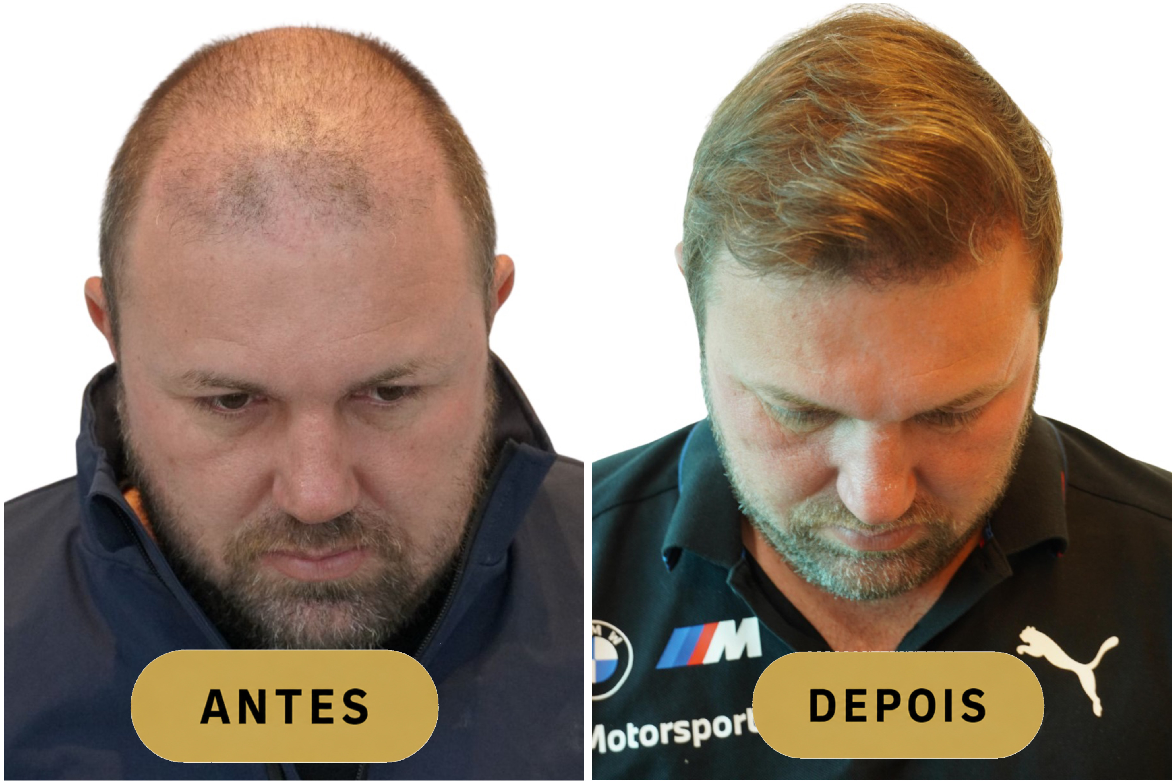 Antes
