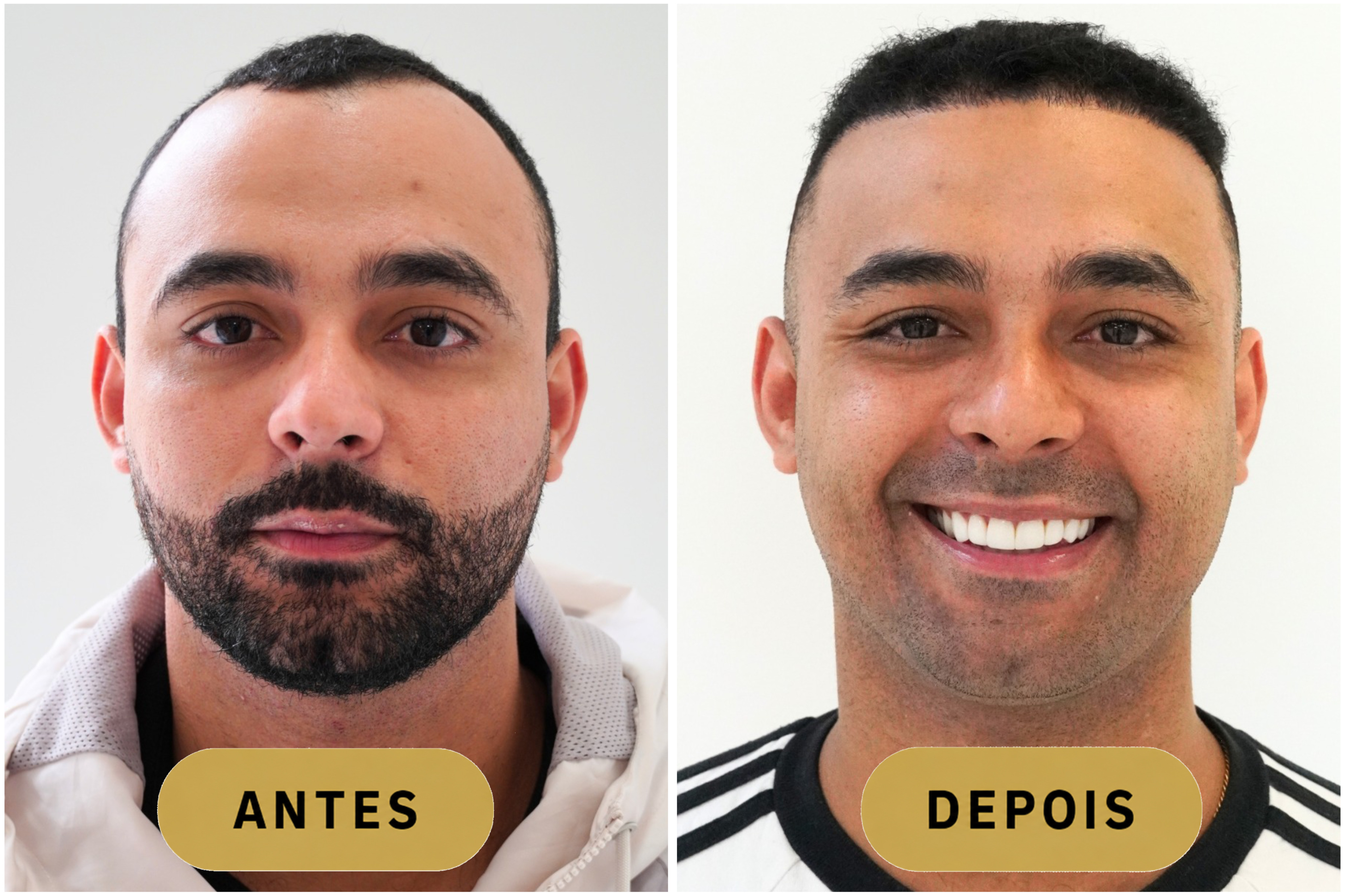 Depois